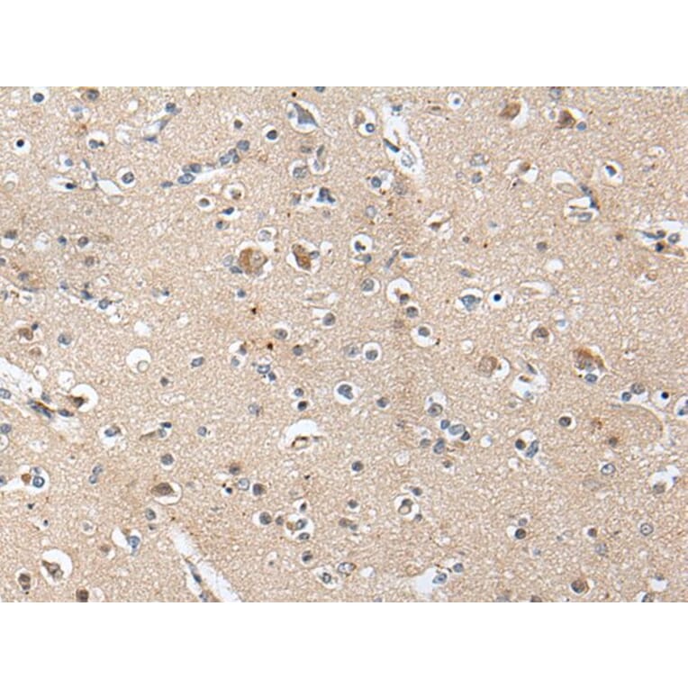 ACAN Antibody from Signalway Antibody (43699) - Antibodies.com