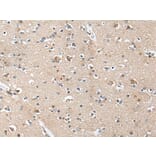 ACAN Antibody from Signalway Antibody (43699) - Antibodies.com