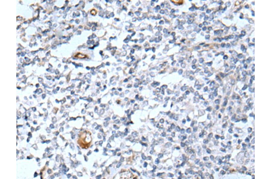 DLK2 Antibody from Signalway Antibody (43718) - Antibodies.com