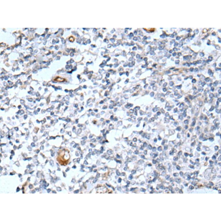 DLK2 Antibody from Signalway Antibody (43718) - Antibodies.com