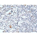 DLK2 Antibody from Signalway Antibody (43718) - Antibodies.com