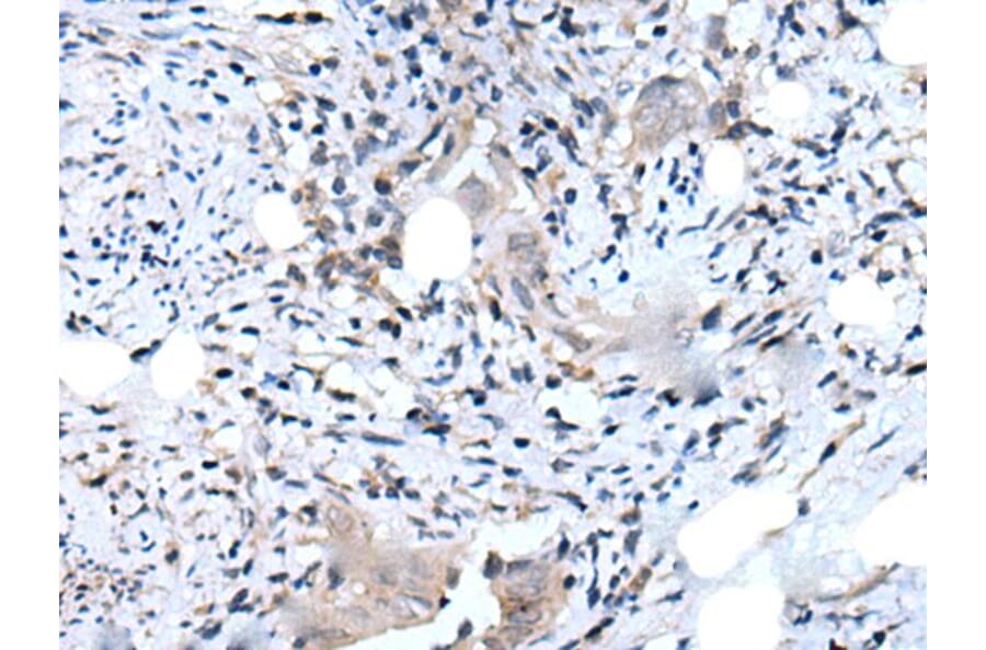 DLK2 Antibody from Signalway Antibody (43718) - Antibodies.com