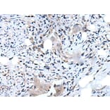 DLK2 Antibody from Signalway Antibody (43718) - Antibodies.com