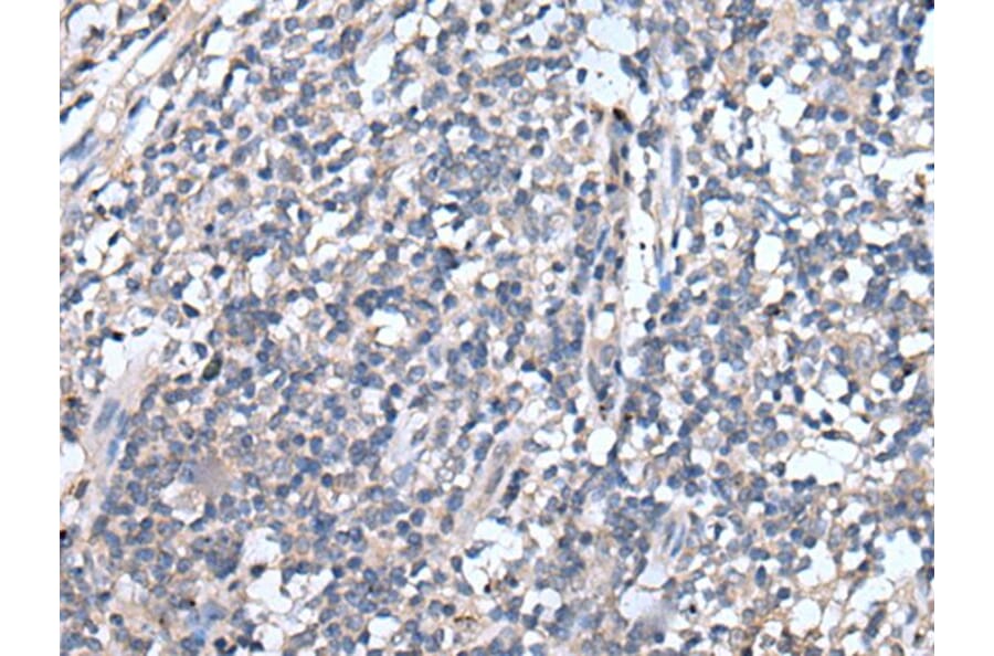 EMP1 Antibody from Signalway Antibody (43720) - Antibodies.com
