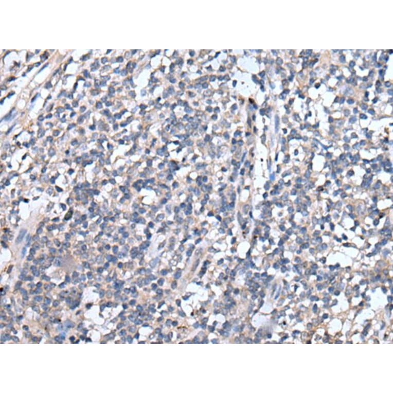 EMP1 Antibody from Signalway Antibody (43720) - Antibodies.com
