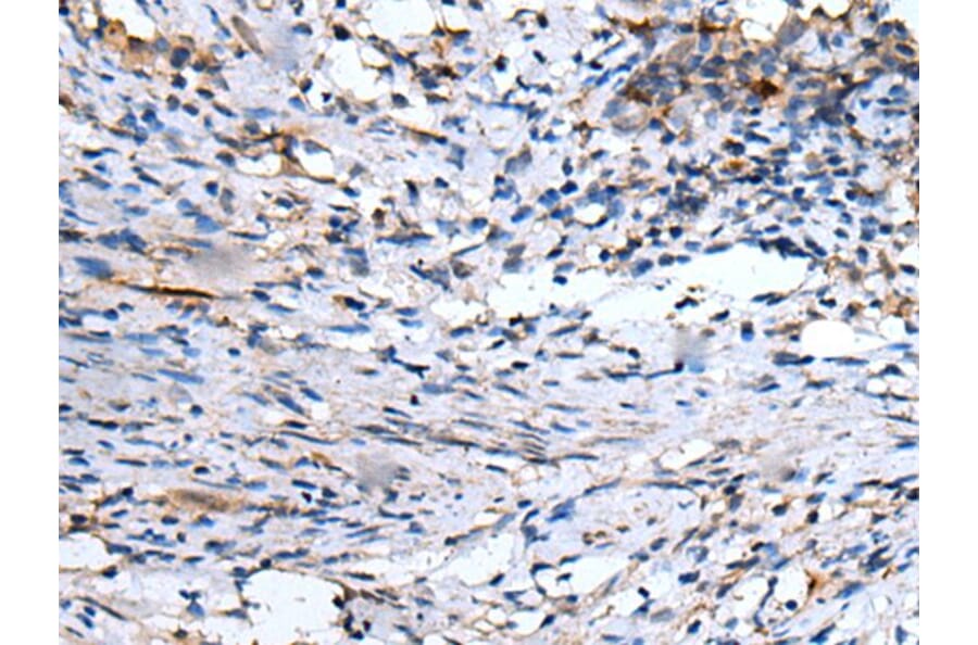 EMP1 Antibody from Signalway Antibody (43720) - Antibodies.com