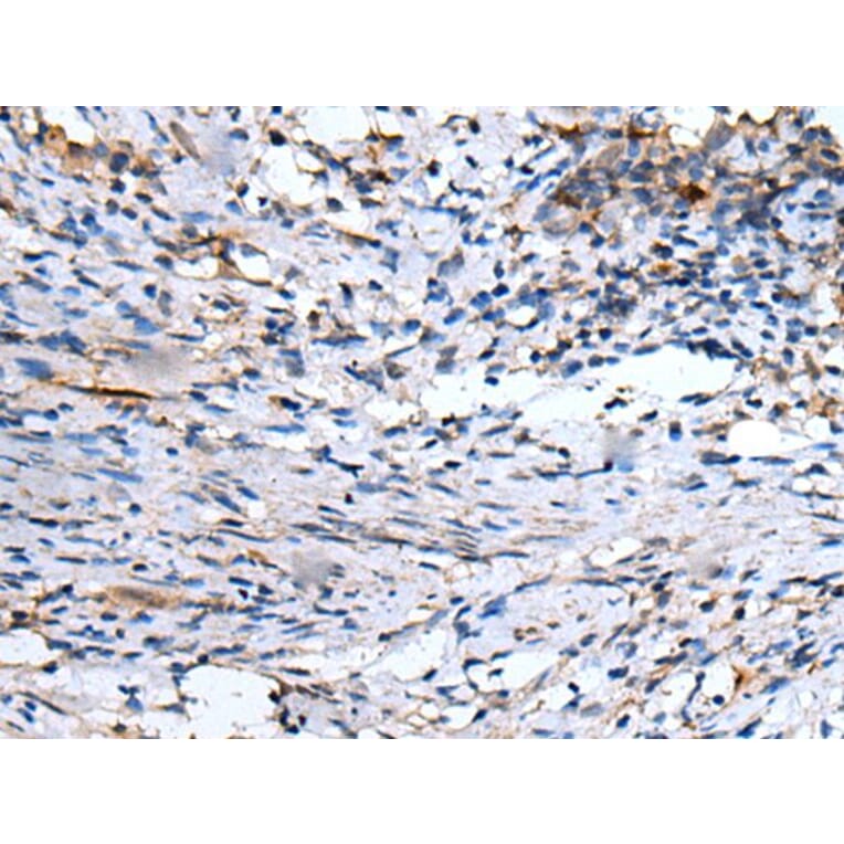 EMP1 Antibody from Signalway Antibody (43720) - Antibodies.com