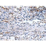 EMP1 Antibody from Signalway Antibody (43720) - Antibodies.com