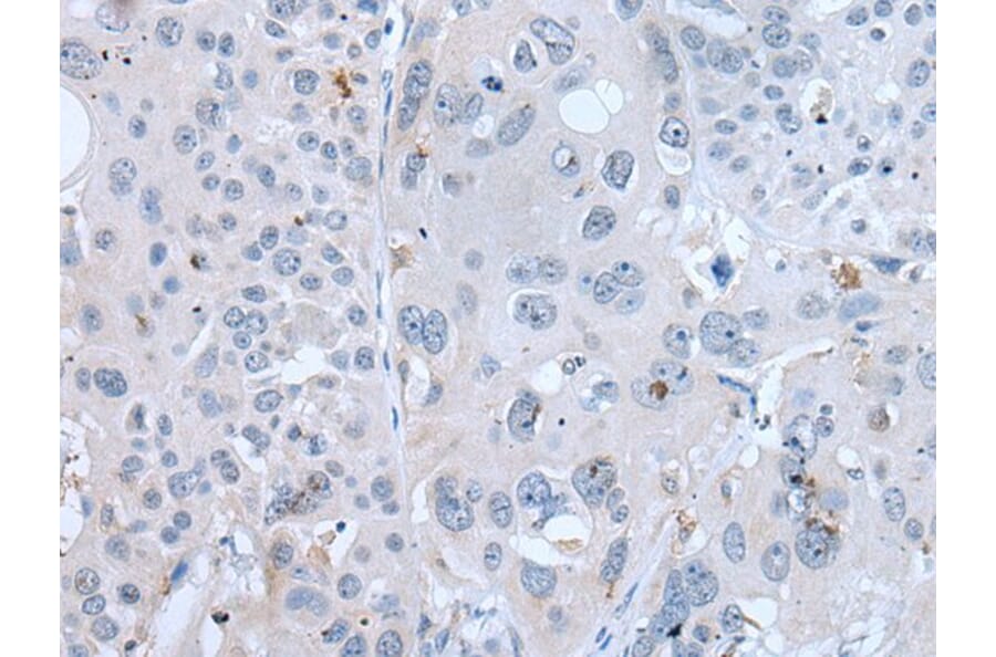 GAST Antibody from Signalway Antibody (43723) - Antibodies.com
