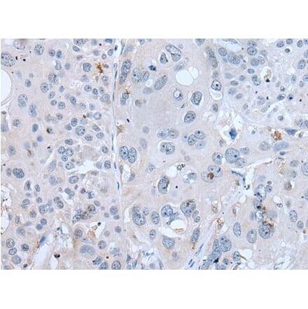 GAST Antibody from Signalway Antibody (43723) - Antibodies.com