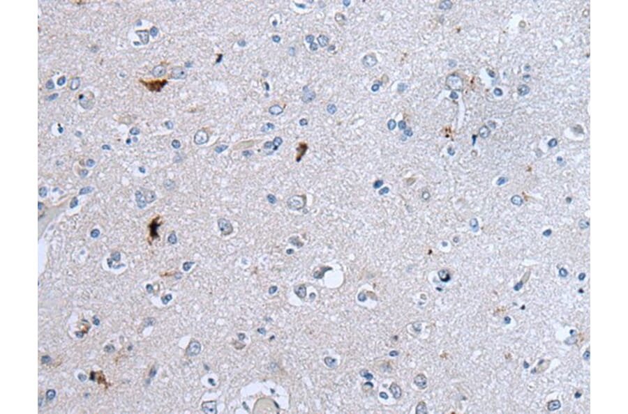 GAST Antibody from Signalway Antibody (43723) - Antibodies.com