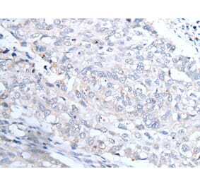 INSR Antibody from Signalway Antibody (43738) - Antibodies.com