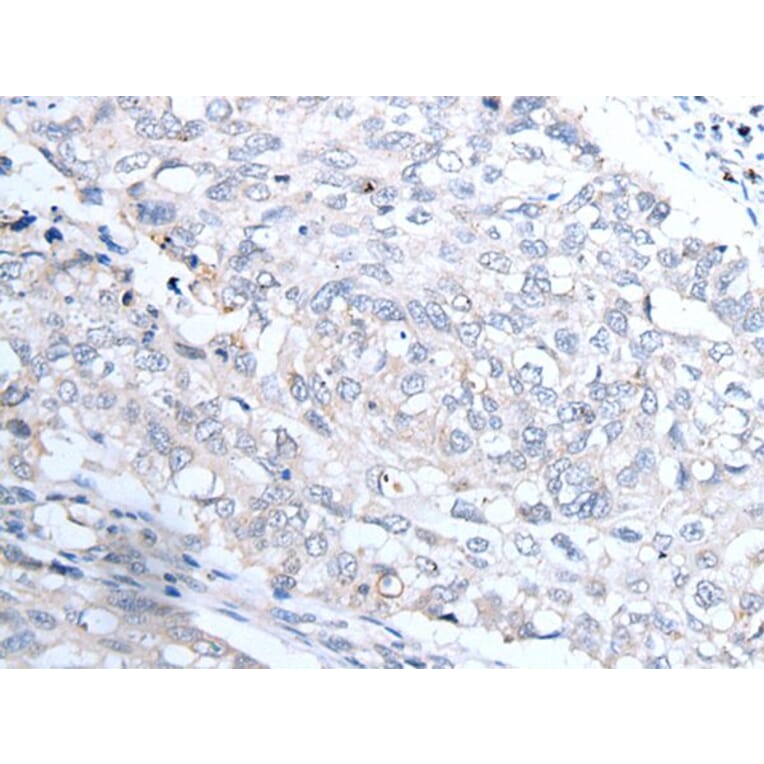 INSR Antibody from Signalway Antibody (43738) - Antibodies.com