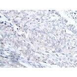 INSR Antibody from Signalway Antibody (43738) - Antibodies.com