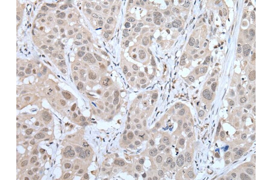 MTA3 Antibody from Signalway Antibody (43754) - Antibodies.com