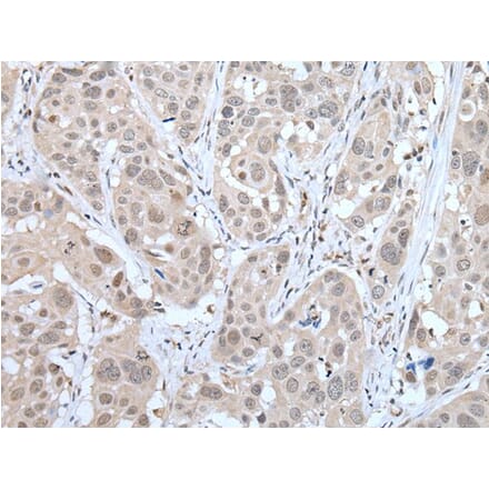 MTA3 Antibody from Signalway Antibody (43754) - Antibodies.com