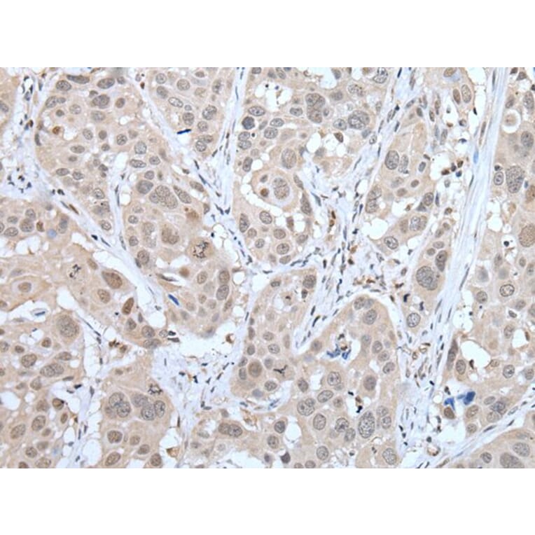 MTA3 Antibody from Signalway Antibody (43754) - Antibodies.com
