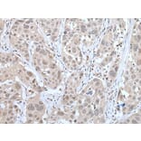 MTA3 Antibody from Signalway Antibody (43754) - Antibodies.com