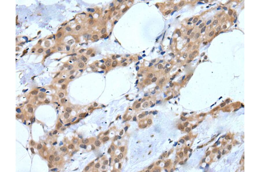 MTA3 Antibody from Signalway Antibody (43754) - Antibodies.com