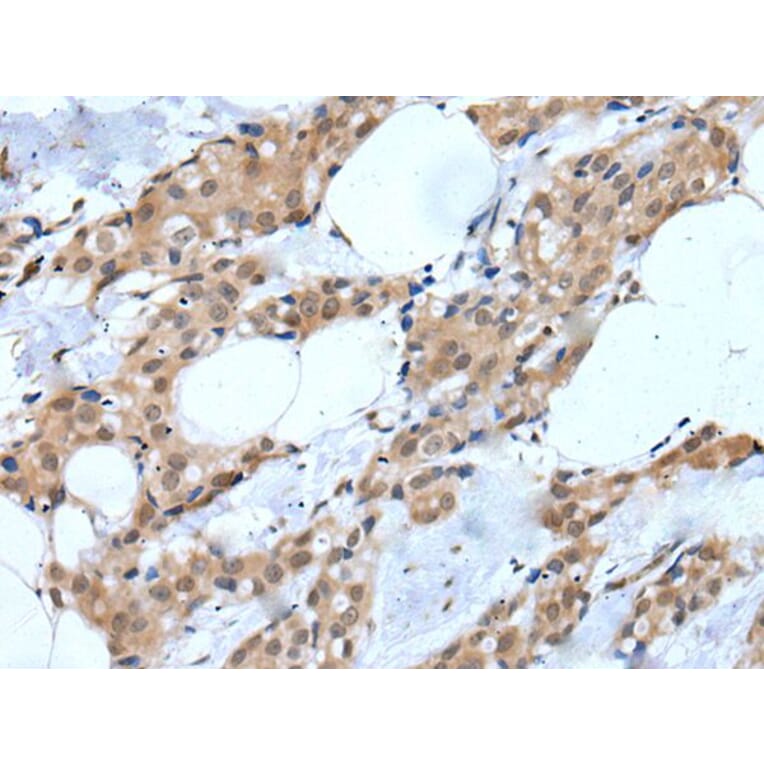 MTA3 Antibody from Signalway Antibody (43754) - Antibodies.com