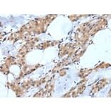MTA3 Antibody from Signalway Antibody (43754) - Antibodies.com