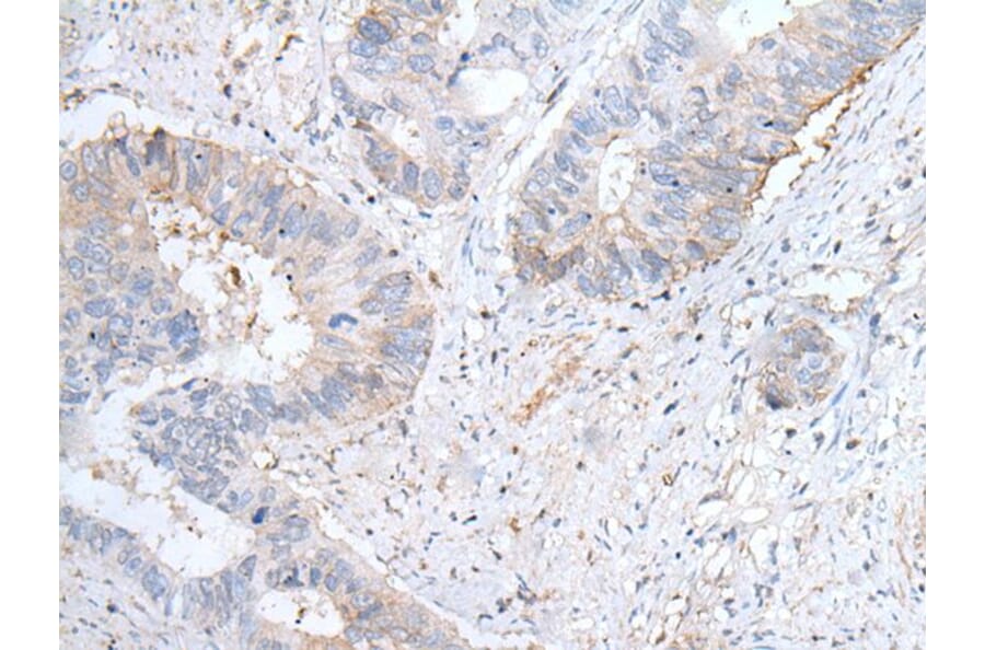 GPD2 Antibody from Signalway Antibody (43763) - Antibodies.com