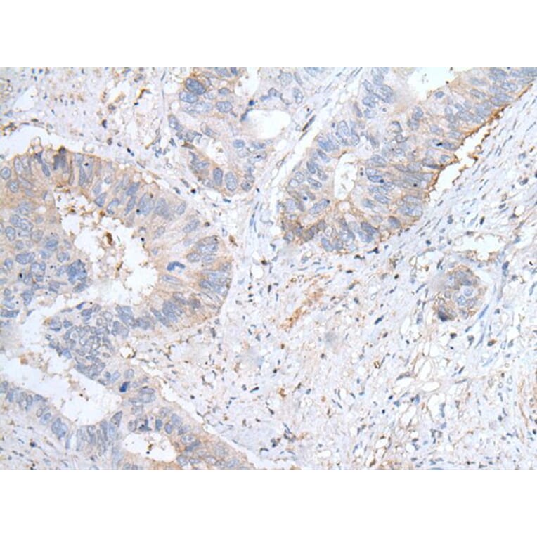GPD2 Antibody from Signalway Antibody (43763) - Antibodies.com