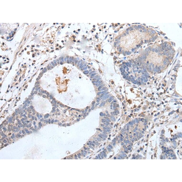 GPD2 Antibody from Signalway Antibody (43763) - Antibodies.com