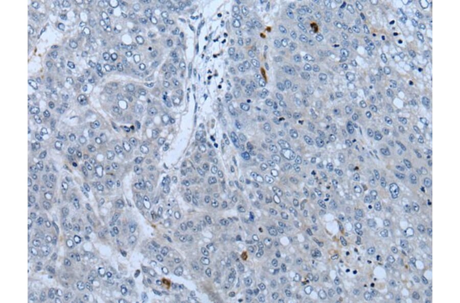 NF1 Antibody from Signalway Antibody (43778) - Antibodies.com