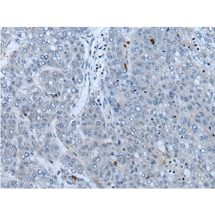 NF1 Antibody from Signalway Antibody (43778) - Antibodies.com