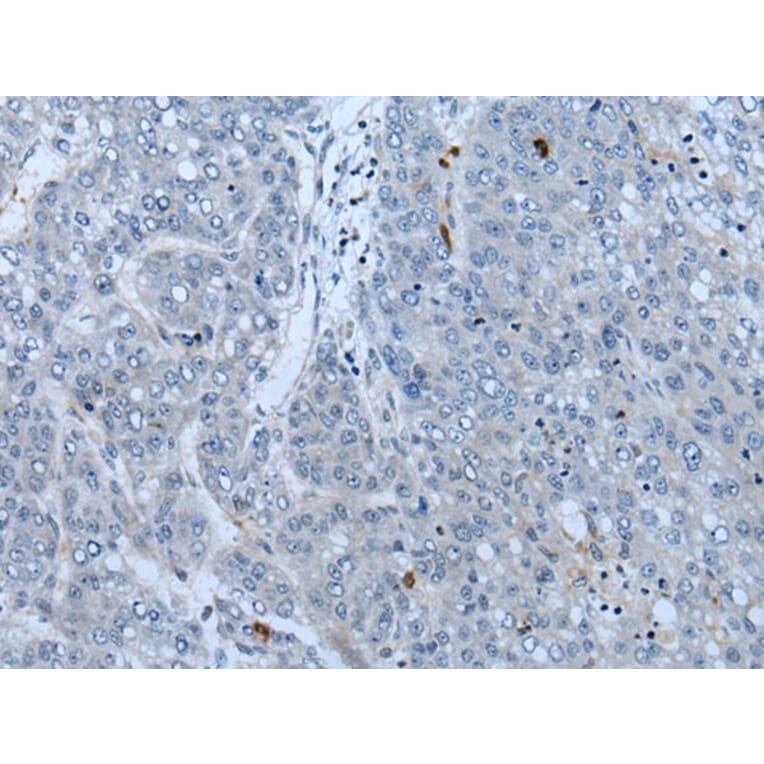 NF1 Antibody from Signalway Antibody (43778) - Antibodies.com