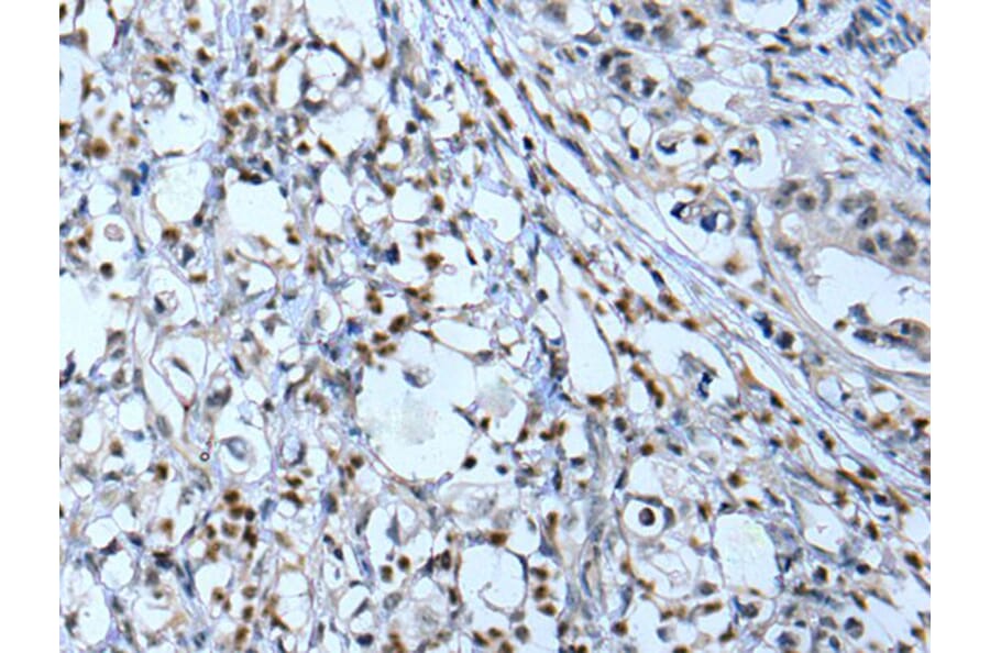 NF1 Antibody from Signalway Antibody (43778) - Antibodies.com