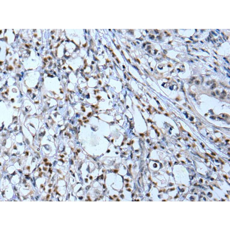 NF1 Antibody from Signalway Antibody (43778) - Antibodies.com