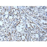 NF1 Antibody from Signalway Antibody (43778) - Antibodies.com