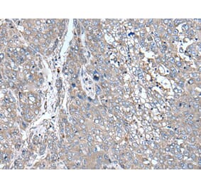 ZIC1 Antibody from Signalway Antibody (43786) - Antibodies.com