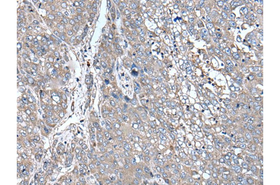 ZIC1 Antibody from Signalway Antibody (43786) - Antibodies.com