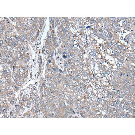 ZIC1 Antibody from Signalway Antibody (43786) - Antibodies.com