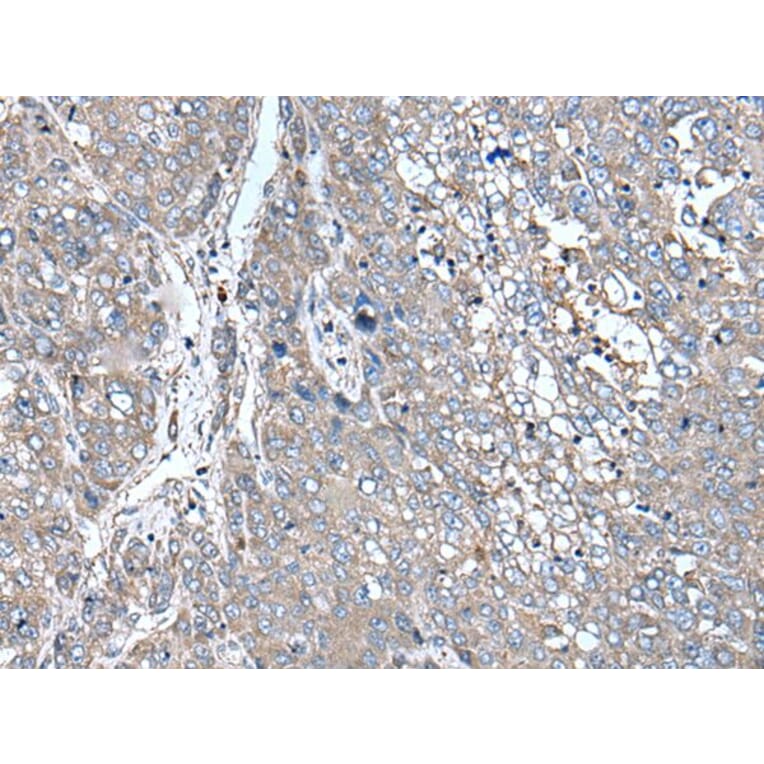 ZIC1 Antibody from Signalway Antibody (43786) - Antibodies.com