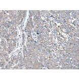 ZIC1 Antibody from Signalway Antibody (43786) - Antibodies.com