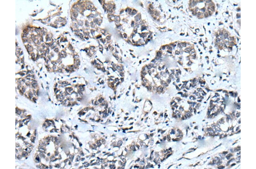 ZIC1 Antibody from Signalway Antibody (43786) - Antibodies.com