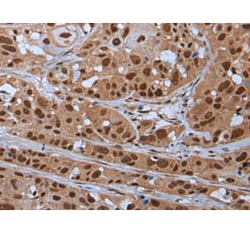 YY2 Antibody from Signalway Antibody (43798) - Antibodies.com