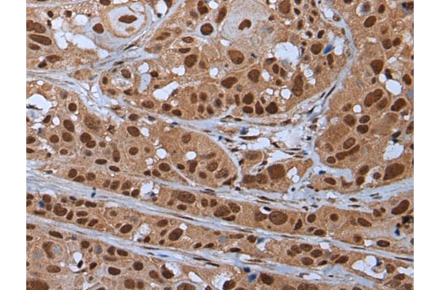 YY2 Antibody from Signalway Antibody (43798) - Antibodies.com