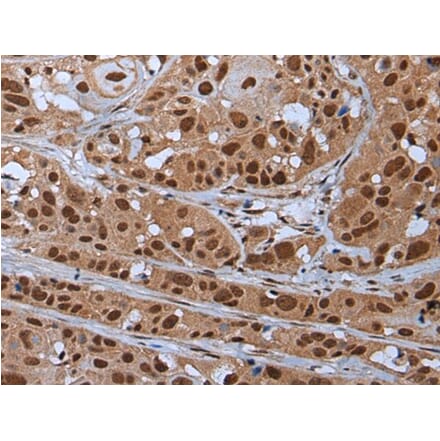 YY2 Antibody from Signalway Antibody (43798) - Antibodies.com