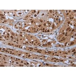 YY2 Antibody from Signalway Antibody (43798) - Antibodies.com