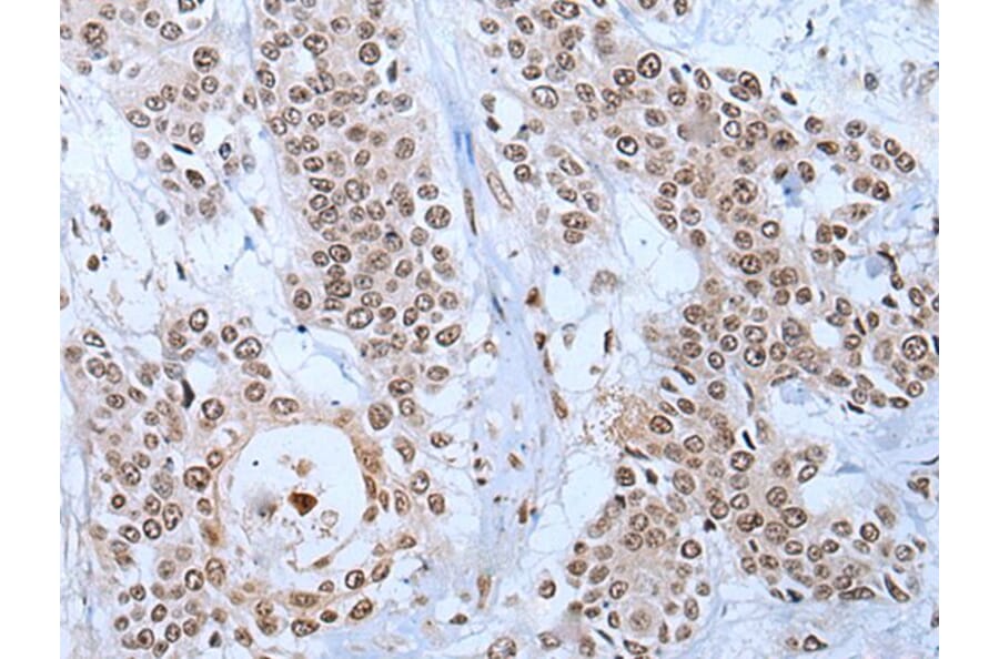 YY2 Antibody from Signalway Antibody (43798) - Antibodies.com