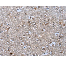 PYM1 Antibody from Signalway Antibody (43811) - Antibodies.com