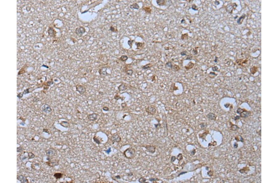 PYM1 Antibody from Signalway Antibody (43811) - Antibodies.com