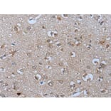 PYM1 Antibody from Signalway Antibody (43811) - Antibodies.com