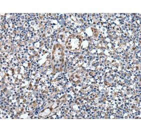 VAX1 Antibody from Signalway Antibody (43818) - Antibodies.com