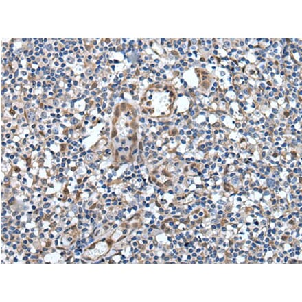VAX1 Antibody from Signalway Antibody (43818) - Antibodies.com